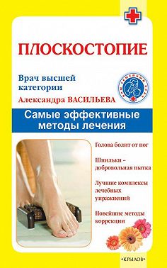 Плоскостопие. Самые эффективные методы лечения