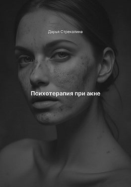 Психотерапия при акне