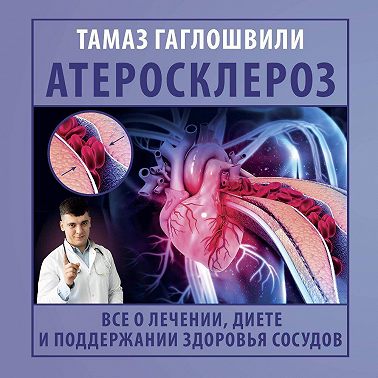 Атеросклероз. Все о лечении, диете и поддержании здоровья сосудов